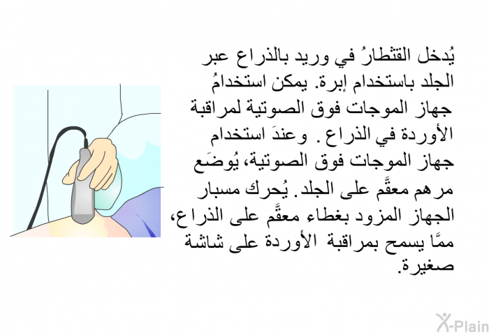 يُدخل القثطارُ في وريد بالذراع عبر الجلد باستخدام إبرة. يمكن استخدامُ جهاز الموجات فوق الصوتية لمراقبة الأوردة في الذراع. وعندَ استخدام جهاز الموجات فوق الصوتية، يُوضَع مرهم معقَّم على الجلد. يُحرك مسبار الجهاز المزود بغطاء معقَّم على الذراع، ممَّا يسمح بمراقبة الأوردة على شاشة صغيرة.