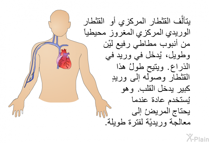 يتألَّف القثطار المركزي أو القثطار الوريدي المركزي المغروز محيطياً من أنبوب مطاطي رفيع ليِّن وطويل، يُدخَل في وريد في الذراع. ويتيح طولُ هذا القثطار وصولَه إلى وريدٍ كبير يدخل القلب. وهو يُستخدم عادة عندما يحتاج المريضُ إلى معالجة وريديَّة لفترة طويلة.