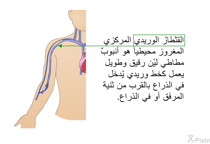 القثطارُ الوريدي المركزي المغروز محيطياً هو أنبوبٌ مطَّاطي ليِّن رقيق وطويل يعمل كخطٍّ وريدي يُدخَل في الذراع بالقرب من ثنية المرفَق أو في الذراع.