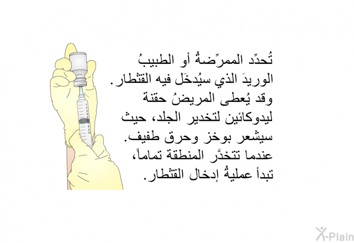 تُحدِّد الممرِّضةُ أو الطبيبُ الوريدَ الذي سيُدخَل فيه القثطار. وقد يُعطَى المريضُ حقنة ليدوكائين لتخدير الجلد، حيث سيشعر بوخز وحرق طفيف. عندما تتخدَّر المنطقة تماماً، تبدأ عمليةُ إدخال القثطار.