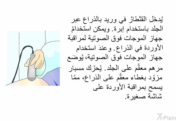 يُدخَل القثطارُ في وريد بالذراع عبر الجلد باستخدام إبرة. ويمكن استخدامُ جهاز الموجات فوق الصوتية لمراقبة الأوردة في الذراع. وعندَ استخدام جهاز الموجات فوق الصوتية، يُوضَع مرهم معقِّم على الجلد. يُحرَّك مسبارٌ مزوَّد بغطاء معقَّم على الذراع، ممَّا يسمح بمراقبة الأوردة على شاشة صغيرة.