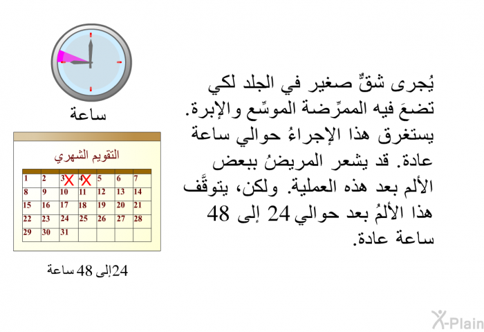 يُجرى شقٌّ صغير في الجلد لكي تضعَ فيه الممرِّضة الموسِّع والإبرة. يستغرق هذا الإجراءُ حوالي ساعة عادة. قد يشعر المريضُ ببعض الألم بعد هذه العملية. ولكن، يتوقَّف هذا الألمُ بعد حوالي 24 إلى 48 ساعة عادة.