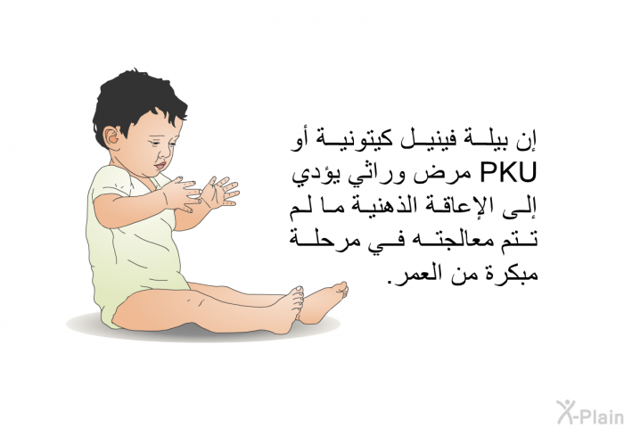 إن بيلة فينيل كيتونية أو PKU مرض وراثي يؤدي إلى الإعاقة الذهنية ما لم تتم معالجته في مرحلة مبكرة من العمر.