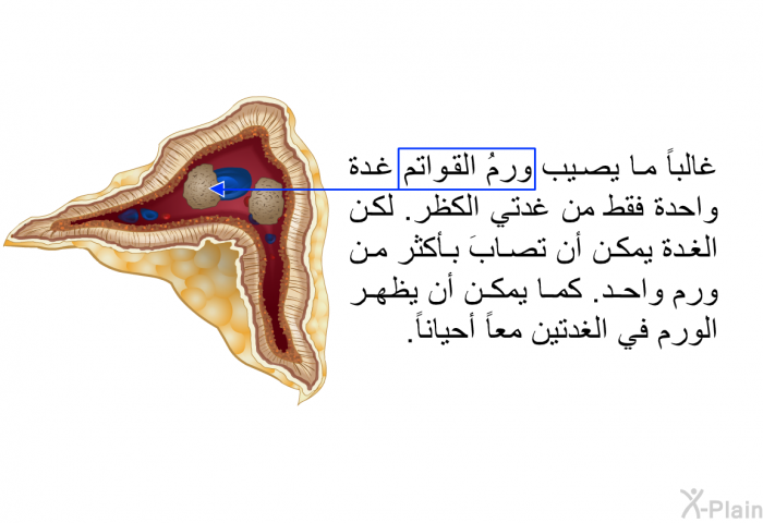 غالباً ما يصيب ورمُ القواتم غدة واحدة فقط من غدتي الكظر. لكن الغدة يمكن أن تصابَ بأكثر من ورم واحد. كما يمكن أن يظهر الورم في الغدتين معاً أحياناً.