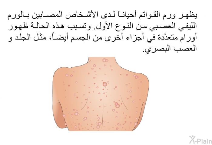 يظهر ورم القواتم أحياناً لدى الأشخاص المصابين بالورم الليفي العصبي من النوع الأول. وتسبب هذه الحالة ظهور أورام متعدِّدة في أجزاء أخرى من الجسم أيضاً، مثل الجلد و العصب البصري.