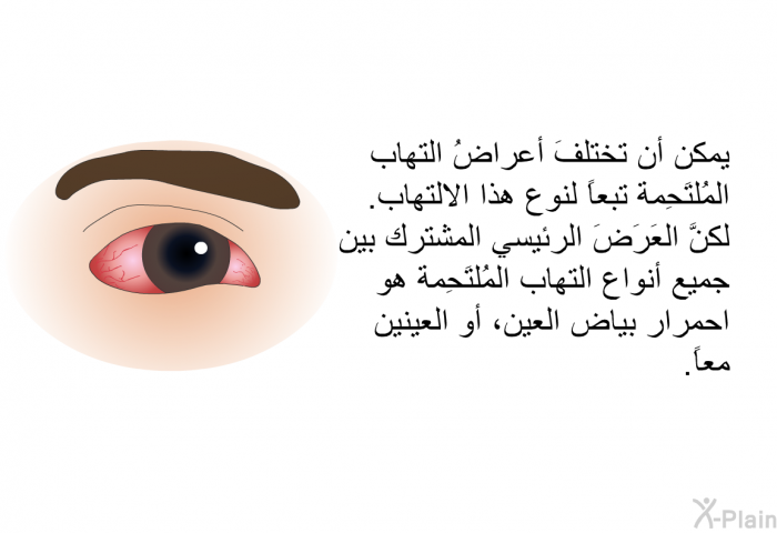 يمكن أن تختلفَ أعراضُ التهاب المُلتَحِمة تبعاً لنوع هذا الالتهاب. لكنَّ العَرَضَ الرئيسي المشترك بين جميع أنواع التهاب المُلتَحِمة هو احمرار بياض العين، أو العينين معاً.