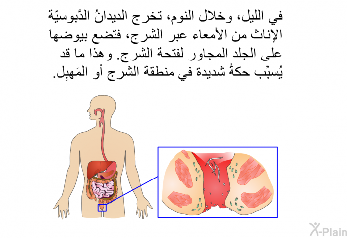 في الليل، وخلال النوم، تخرج الديدانُ الدَّبوسيّة الإناث من الأمعاء عبر الشرج، فتضع بيوضها على الجلد المجاور لفتحة الشرج. وهذا ما قد يُسبِّب حكةً شديدة في منطقة الشرج أو المَهبِل.