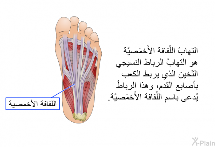 التهابُ اللِّفافة الأَخمَصيَّة هو التهابُ الرباط النسيجي الثخين الذي يربط الكعب بأصابع القدم، وهذا الرباطُ يُدعى باسم اللِّفافة الأَخمَصيَّة.