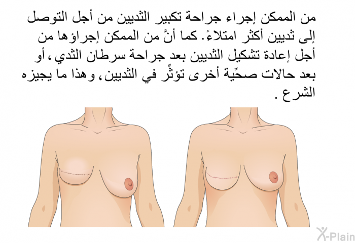 من الممكن إجراء جراحة تكبير الثديين من أجل التوصل إلى ثديين أكثر امتلاءً. كما أنَّ من الممكن إجراؤها من أجل إعادة تشكيل الثديين بعد جراحة سرطان الثدي، أو بعد حالات صحِّية أخرى تؤثِّر في الثديين، وهذا ما يجيزه الشرع.