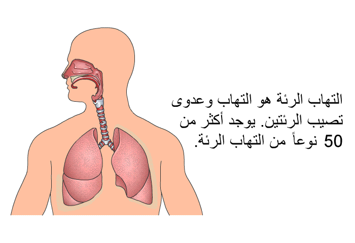 التهاب الرئة هو التهاب وعدوى تصيب الرئتين. يوجد أكثر من 50 نوع من التهاب الرئة.