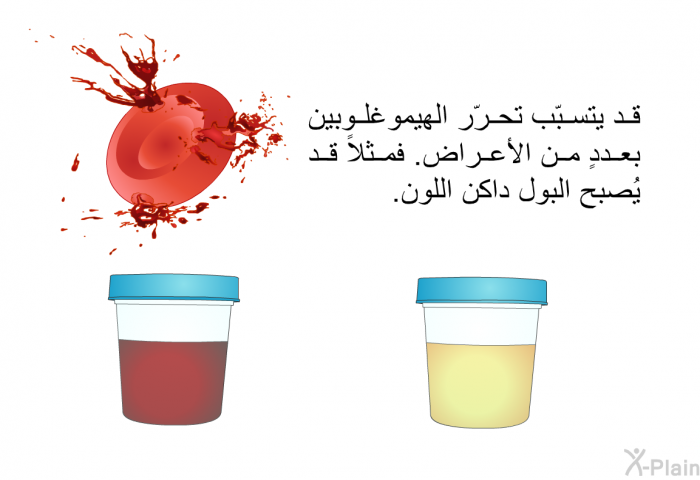 قد يتسبّب تحرّر الهيموغلوبين بعددٍ من الأعراض. فمثلاً قد يُصبح البول داكن اللون.