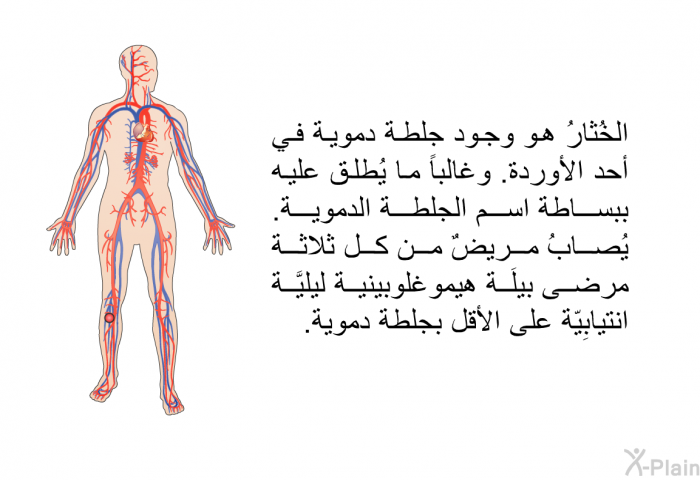 الخُثارُ هو وجود جلطة دموية في أحد الأوردة. وغالباً ما يُطلق عليه ببساطة اسم الجلطة الدموية. يُصابُ مريضٌ من كل ثلاثة مرضى بيلَة هيموغلوبينية ليليَّة انتيابِيّة على الأقل بجلطة دموية.