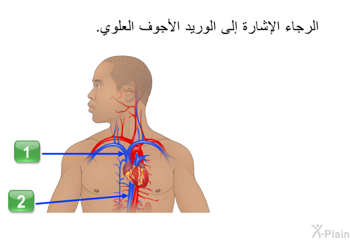 الرجاء الإشارة إلى الوريد الأجوف العلوي.