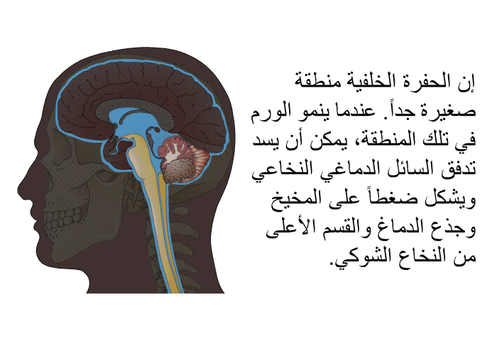 إن الحفرة الخلفية منطقة صغيرةٌ جداً<B>. </B>عندما ينمو الورم في تلك المنطقة، يمكن أن يسد تدفق السائل الدماغي النخاعي ويشكل ضغطاً على المخيخ وجذع الدماغ والقسم الأعلى من النخاع الشوكي<B>. </B>
