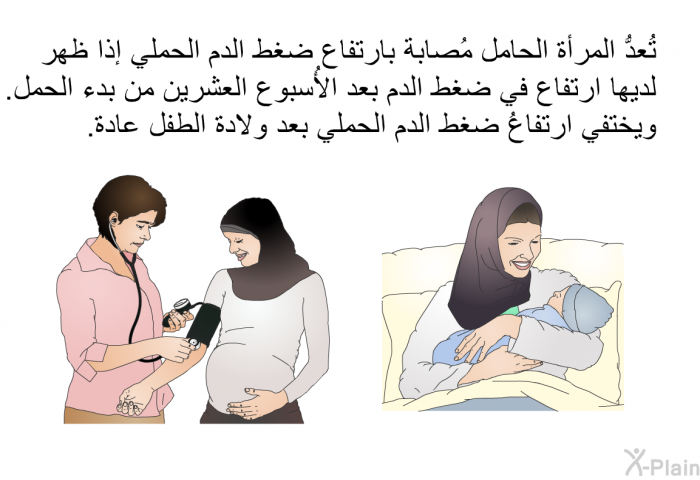 تُعدُّ المرأة الحامل مُصابة بارتفاع ضغط الدم الحملي إذا ظهر لديها ارتفاع في ضغط الدم بعد الأُسبوع العشرين من بدء الحمل. ويختفي ارتفاعُ ضغط الدم الحملي بعد ولادة الطفل عادة.