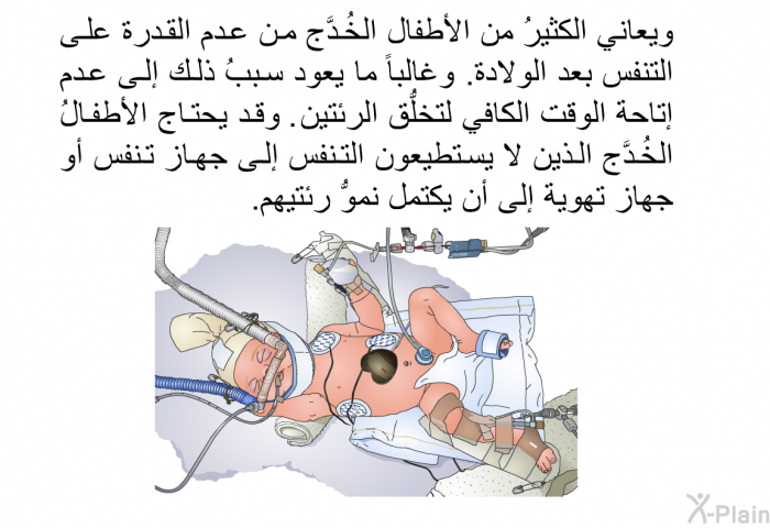 ويعاني الكثيرُ من الأطفال الخُدَّج من عدم القدرة على التنفس بعد الولادة. وغالباً ما يعود سببُ ذلك إلى عدم إتاحة الوقت الكافي لتخلُّق الرئتين. وقد يحتاج الأطفالُ الخُدَّج الذين لا يستطيعون التنفس إلى جهاز تنفس أو جهاز تهوية إلى أن يكتمل نموُّ رئتيهم.