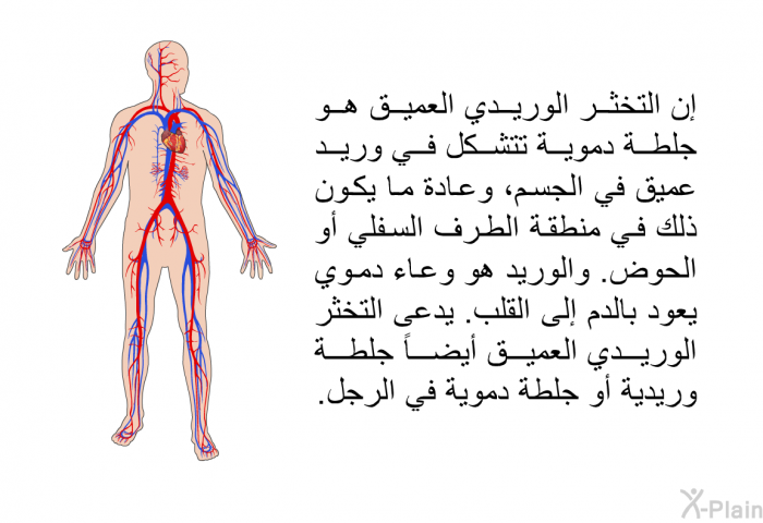 إن التخثر الوريدي العميق هو جلطة دموية تتشكل في وريد عميق في الجسم، وعادة ما يكون ذلك في منطقة الطرف السفلي أو الحوض. والوريد هو وعاء دموي يعود بالدم إلى القلب. يدعى التخثر الوريدي العميق أيضاً جلطة وريدية أو جلطة دموية في الرجل.