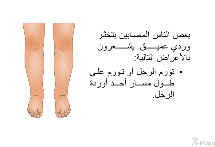 بعض الناس المصابين بتخثر وردي عميق يشعرون بالأعراض التالية:   تورم الرجل أو تورم على طول مسار أحد أوردة الرجل.