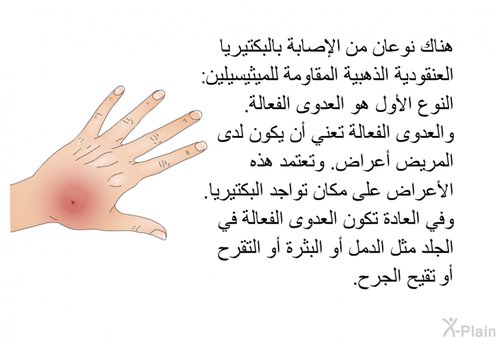 هناك نوعان من الإصابة بالبكتيريا العنقودية الذهبية المقاومة للميثيسيلين: النوع الأول هو العدوى الفعالة. والعدوى الفعالة تعني أن يكون لدى المريض أعراض. وتعتمد هذه الأعراض على مكان تواجد البكتيريا. وفي العادة تكون العدوى الفعالة في الجلد مثل الدمل أو البثرة أو التقرح أو تقيح الجرح.