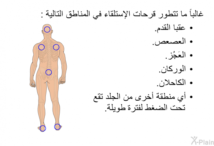 غالباً ما تتطور قرحات الإستلقاء في المناطق التالية :  عقبا القدم. العصعص. العَجُز. الوركان. الكاحلان. أي منطقة أخرى من الجلد تقع تحت الضغط لفترة طويلة.