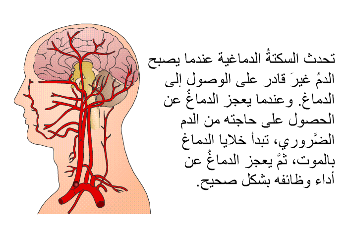 تحدث السكتةُ الدماغية عندما يصبح الدمُ غيرَ قادر على الوصول إلى الدماغ<I>. </I>وعندما يعجز الدماغُ عن الحصول على حاجته من الدم الضَّروري، تبدأ خلايا الدماغ بالموُّت، ثمَّ يعجز الدماغُ عن أداء وظائفه بشكل صحيح<I>.</I>