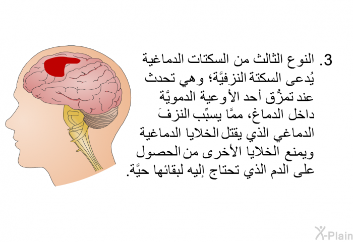 نوع من السكتات الدماغية يُدعى السكتةَ النزفيَّة؛ وهي تحدث عند تمزُّق أحد الأوعية الدمويَّة داخل الدماغ، ممَّا يسبِّب النزفَ الدماغي الذي يقتل الخلايا الدماغية ويمنع الخلايا الأخرى من الحصول على الدم الذي تحتاج إليه لبقائها حيَّة.
