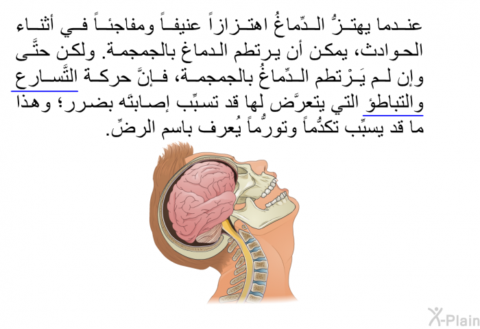 عندما يهتزُّ الدِّماغُ اهتزازاً عنيفاً ومفاجئاً في أثناء الحوادث، يمكن أن يرتطم الدماغ بالجمجمة. ولكن حتَّى وإن لم يَرْتطم الدِّماغُ بالجمجمة، فإنَّ حركةَ التَّسارع والتباطؤ التي يتعرَّض لها قد تسبِّب إصابتَه بضرر؛ وهذا ما قد يسبِّب تكدُّماً وتورُّماً يُعرف باسم الرضِّ.