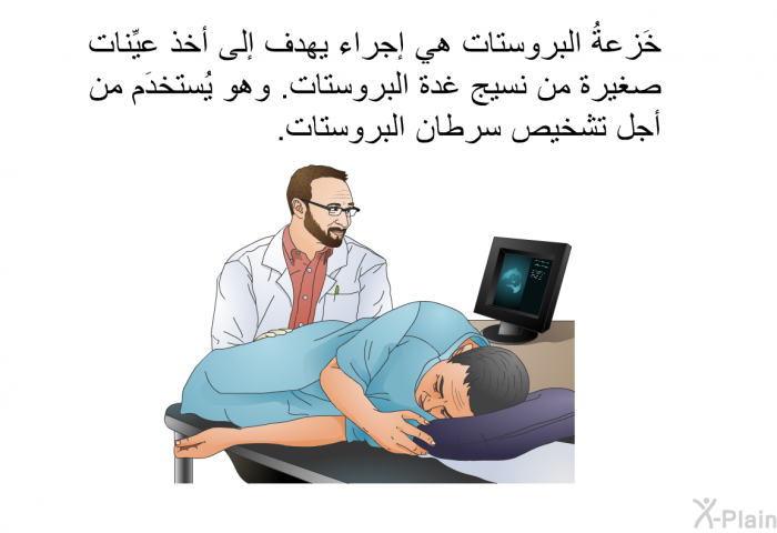 خَزعةُ البروستات هي إجراء يهدف إلى أخذ عيِّنات صغيرة من نسيج غدة البروستات. وهو يُستخدَم من أجل تشخيص سرطان البروستات.