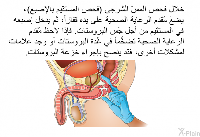 خلال فحص المسّ الشرجي (فحص المستقيم بالإصبع) ، يمكن أن يضعَ مُقدم الرعاية الصحية على يده قفازاً، ثم يدخل إصبعه في المستقيم من أجل جَس البروستات. فإذا لاحظ مُقدم الرعاية الصحية تضخُّماً في غُدة البروستات أو وجد علامات لمشكلات أخرى، فقد ينصح بإجراء خزعة البروستات.