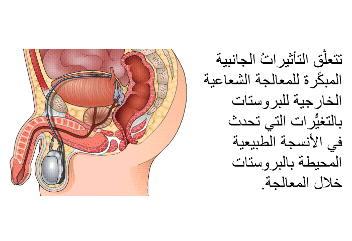 تتعلَّق التأثيراتُ الجانبية المبكِّرة للمعالجة الشعاعية الخارجية للبروستات بالتغيُّرات التي تحدث في الأنسجة الطبيعية المحيطة بالبروستات خلال المعالجة.