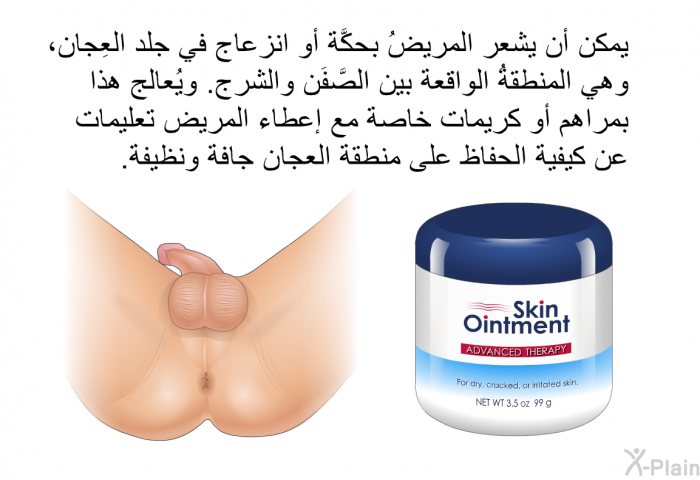 يمكن أن يشعر المريضُ بحكَّة أو انزعاج في جلد العِجان، وهي المنطقةُ الواقعة بين الصَّفَن والشَّرج. ويُعالج هذا بمراهم أو كريمات خاصة مع إعطاء المريض تعليمات عن كيفية الحفاظ على منطقة العجان جافة ونظيفة.