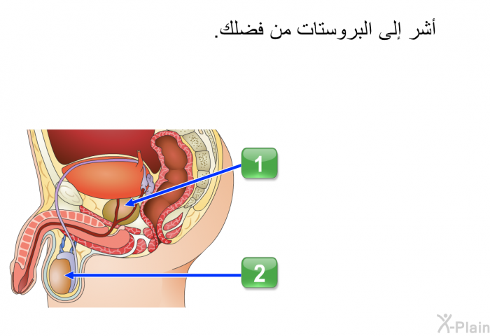 أشر إلى البروستات من فضلك.