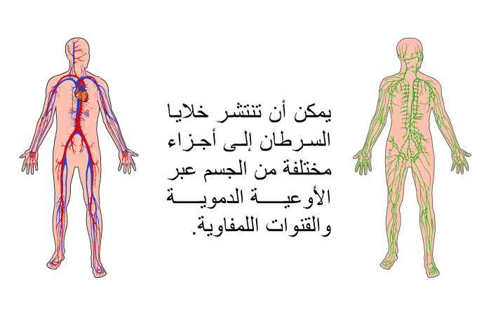يمكن أن تنتشر خلايا السرطان إلى أجزاء مختلفة من الجسم عبر الأوعية الدموية والقنوات اللمفاوية.