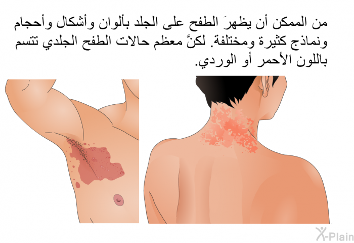 من الممكن أن يظهرَ الطفح على الجلد بألوان وأشكال وأحجام ونماذج كثيرة ومختلفة. لكنَّ معظم حالات الطفح الجلدي تتسم باللون الأحمر أو الوردي.