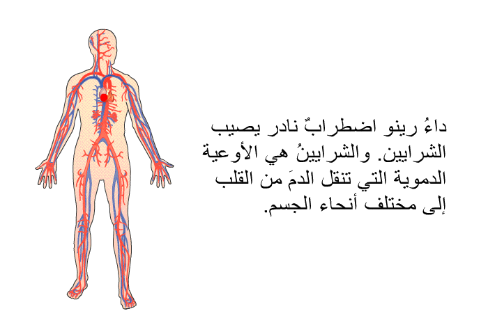 داءُ رينو اضطرابٌ نادر يصيب الشرايين. والشرايينُ هي الأوعيةُ الدموية التي تنقل الدمَ من القلب إلى مختلف أنحاء الجسم.