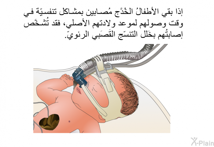 إذا بقي الأطفالُ الخُدَّج مُصابين بمشاكل تنفسيّة في وقت وصولهم لموعد ولادتهم الأصلي، فقد تُشخَّص إصابتُهم بخَلل التنسّج القَصَبي الرئويّ.