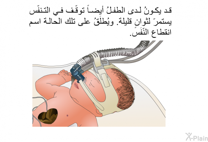 قد يكونُ لدى الطفلُ أيضاً توقّف في التنفّس يستمرّ لثوانٍ قليلة. ويُطلَقُ على تلك الحالة اسم انقطاع النّفَس.