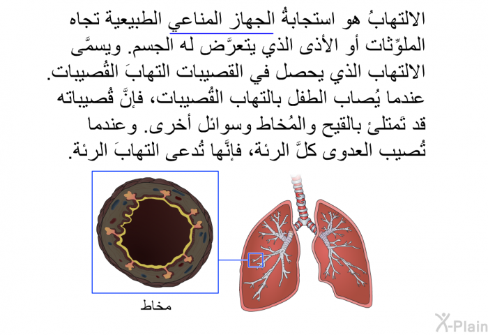 الالتهابُ هو استجابةُ الجهاز المناعي الطبيعية تجاه الملوِّثات أو الأذى الذي يتعرَّض له الجسم. ويسمَّى الالتهاب الذي يحصل في القصيبات التهابَ القُصيبات. عندما يُصاب الطفل بالتهاب القُصيبات، فإنَّ قُصيباته قد تَمتلئ بالقيح والمُخاط وسوائل أخرى. وعندما تُصيب العدوى كلَّ الرئة، فإنَّها تُدعى التهابَ الرئة.