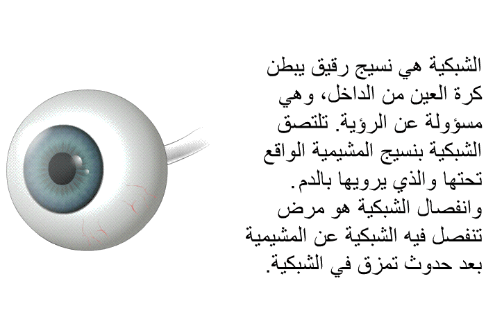 الشبكية هي نسيج رقيق يبطن كرة العين من الداخل، وهي مسؤولة عن الرؤية. تلتصق الشبكية بنسيج المشيمية الواقع تحتها والذي يرويها بالدم. وانفصال الشبكية هو مرض تنفصل فيه الشبكية عن المشيمية بعد حدوث تمزق في الشبكية.