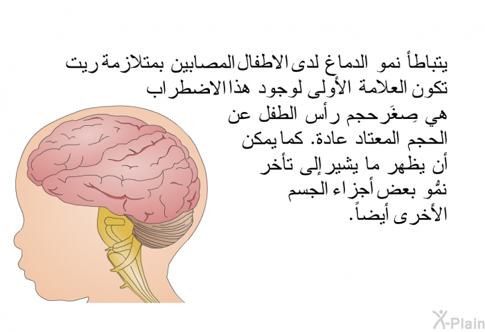 يتباطأ نمو الدماغ لدى الاطفال المصابين بمتلازمة ريت تكون العلامةُ الأولى لوجود هذا الاضطراب هي صِغَر حجم رأس الطفل عن الحجم المعتاد عادة. كما يمكن أن يظهر ما يشير إلى تأخُّر نمو بعض أجزاء الجسم الأخرى أيضاً.