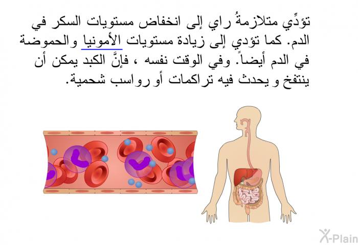 تؤدِّي متلازمةُ راي إلى انخفاض مستويات السكر في الدم. كما تؤدي إلى زيادة مستويات الأمونيا والحموضة في الدم أيضاً. وفي الوقت نفسه ، فإنَّ الكبد يمكن أن ينتفخ و يحدث فيه تراكمات أو رواسب شحمية.