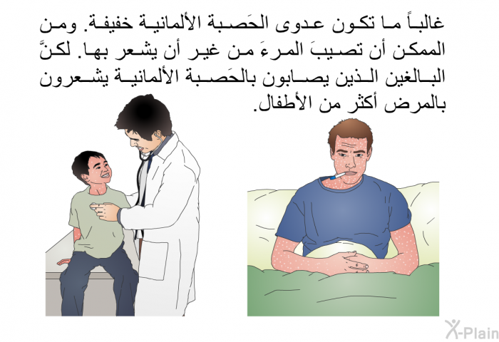 غالباً ما تكون عدوى الحَصبة الألمانية خفيفة. ومن الممكن أن تصيبَ المرءَ من غير أن يشعر بها. لكنَّ البالغين الذين يصابون بالحَصبة الألمانية يشعرون بالمرض أكثر من الأطفال.