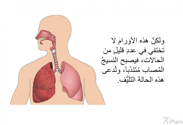 ولكنَّ هذه الأورامَ لا تختفي في عددٍ قليلٍ من الحالات، فيصبح النسيجُ المُصاب مُتَنَدِّباً، وتُدعى هذه الحالة التلَيُّف.