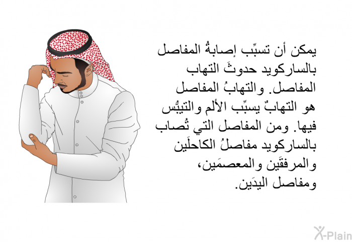 يمكن أن تسبِّب إصابةُ المفاصل بالساركويد حدوثَ التهاب المفاصل. والتهابُ المفاصل هو التهابٌ يسبِّب الألم والتيبُّس فيها. ومن المفاصل التي تُصاب بالساركويد مفاصلُ الكاحلَين والمرفقَين والمعصمَين، ومفاصل اليدَين.