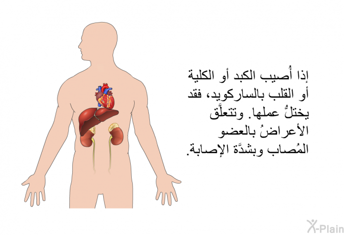 إذا أُصيب الكبد أو الكلية أو القلب بالساركويد، فقد يختلُّ عملها. وتتعلَّق الأعراضُ بالعضو المُصاب وبشدَّة الإصابة.