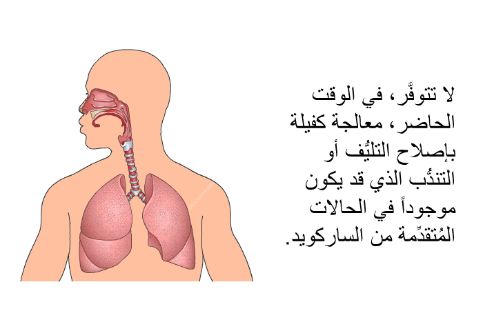 لا تتوفَّر، في الوقت الحاضر، معالجةٌ كفيلة بإصلاح التليُّف أو التندُّب الذي قد يكون موجوداً في الحالات المُتقدِّمة من الساركويد.