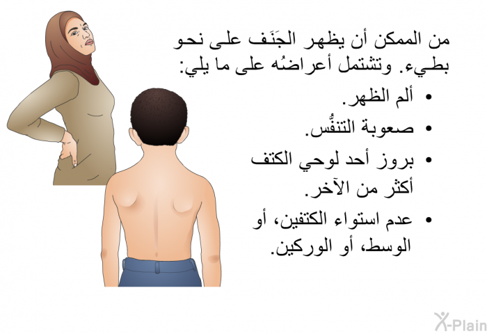 من الممكن أن يظهر الجَنَف على نحو بطيء. وتشتمل أعراضُه على ما يلي:  ألم الظهر. صعوبة التنفُّس. بروز أحد لوحي الكتف أكثر من الآخر. عدم استواء الكتفين، أو الوسط، أو الوركين.