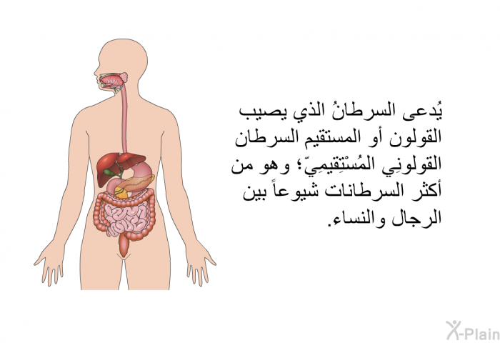 يُدعى السرطانُ الذي يصيب القولون أو المستقيم "السرطان
القولونِيٌّ المُسْتِقيمِيّ"؛ وهو من أكثر السرطانات شيوعاً بين الرجال والنساء.