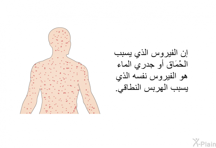 إن الفيروس الذي يسبب الحُمَاق أو جدري الماء هو الفيروس نفسه الذي يسبب الهربس النطاقي .