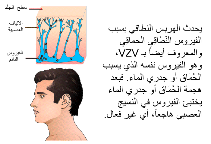 يحدث الهربس النطاقي بسبب الفيروس النّطاقِي الحماقِي والمعروف أيضاً بـ VZV، وهو الفيروس نفسه الذي يسبب الحُمَاق أو جدري الماء. فبعد هجمة الحُمَاق أو جدري الماء يختبئ الفيروس في النسيج العصبي هاجعاً، أي غير فعال.